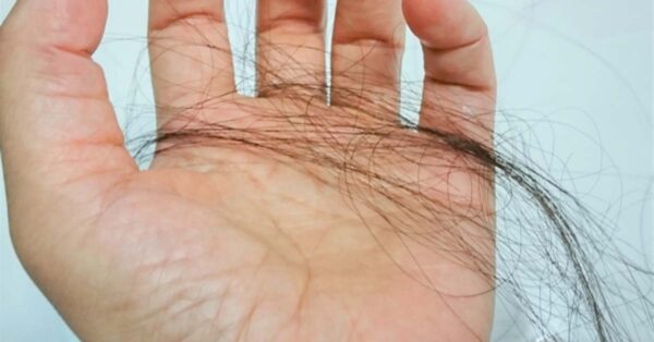 髪の毛を抜いてしまう抜毛症の原因と治し方